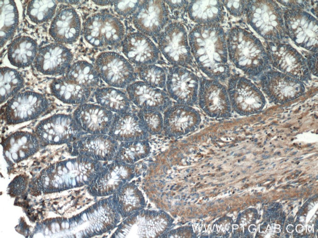 HTRA2 Antibody in Immunohistochemistry (Paraffin) (IHC (P))