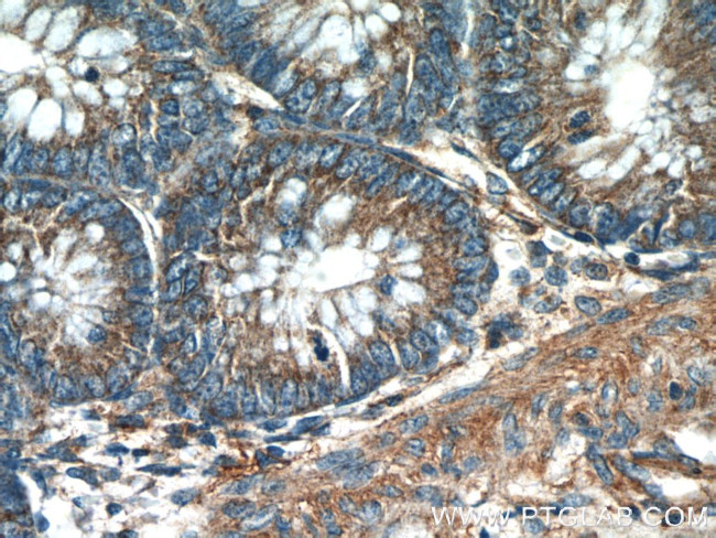 HTRA2 Antibody in Immunohistochemistry (Paraffin) (IHC (P))