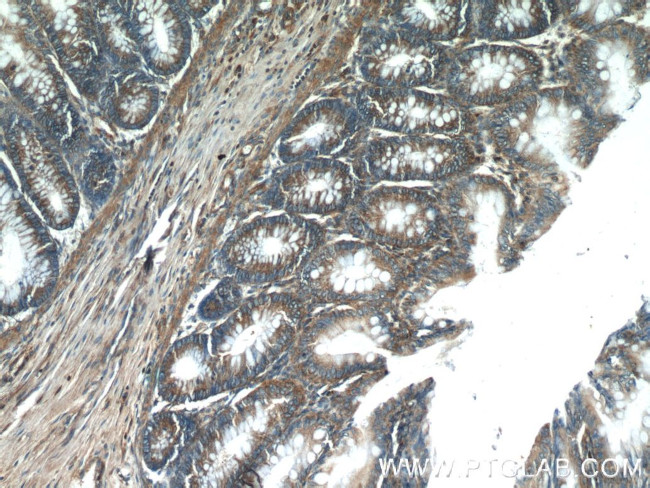 HTRA2 Antibody in Immunohistochemistry (Paraffin) (IHC (P))