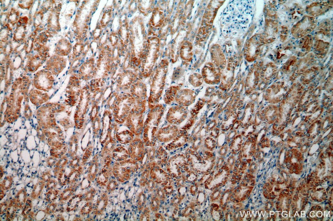 HTRA2 Antibody in Immunohistochemistry (Paraffin) (IHC (P))