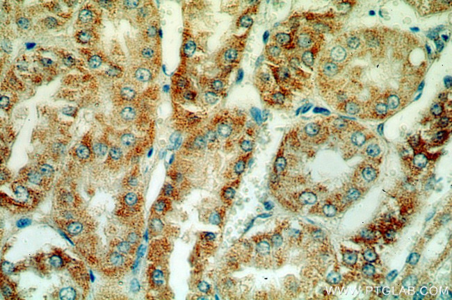 HTRA2 Antibody in Immunohistochemistry (Paraffin) (IHC (P))