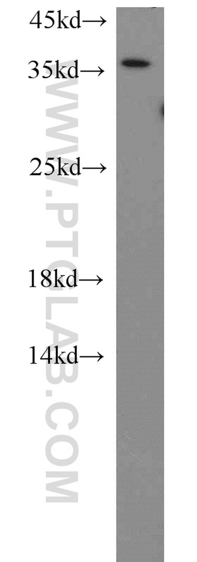 HTRA2 Antibody in Western Blot (WB)