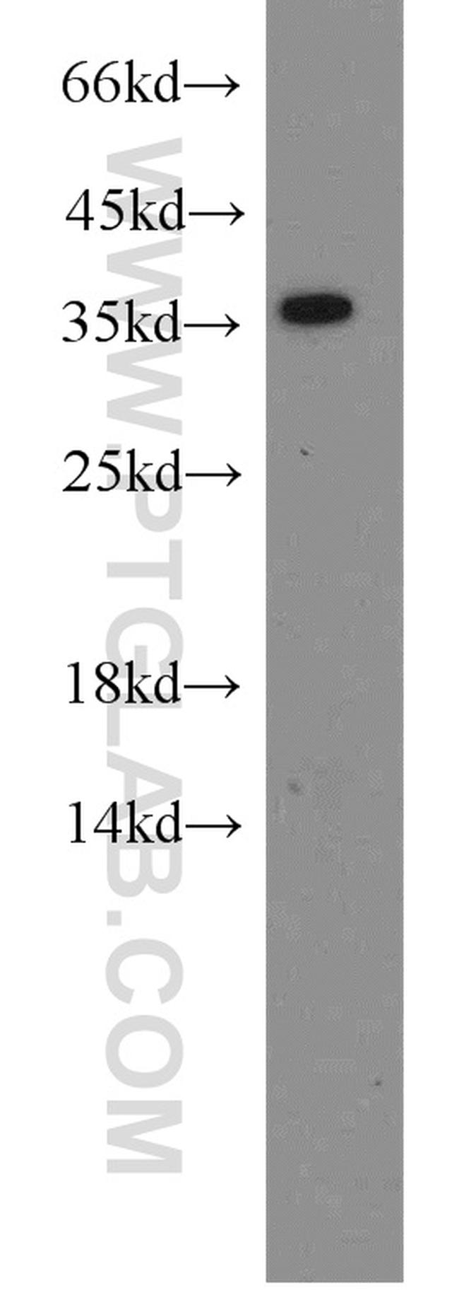 HTRA2 Antibody in Western Blot (WB)