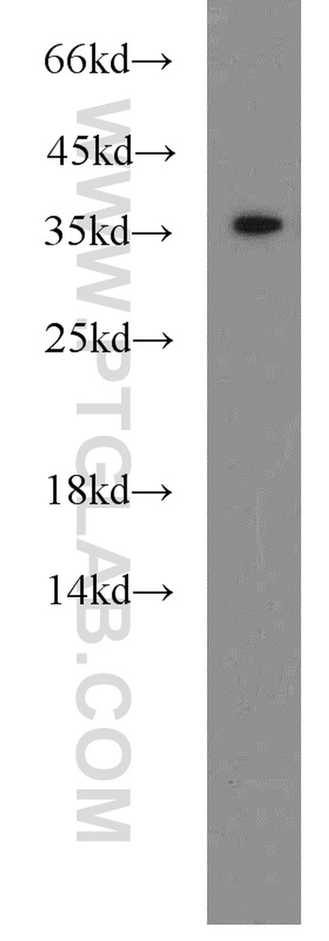 HTRA2 Antibody in Western Blot (WB)