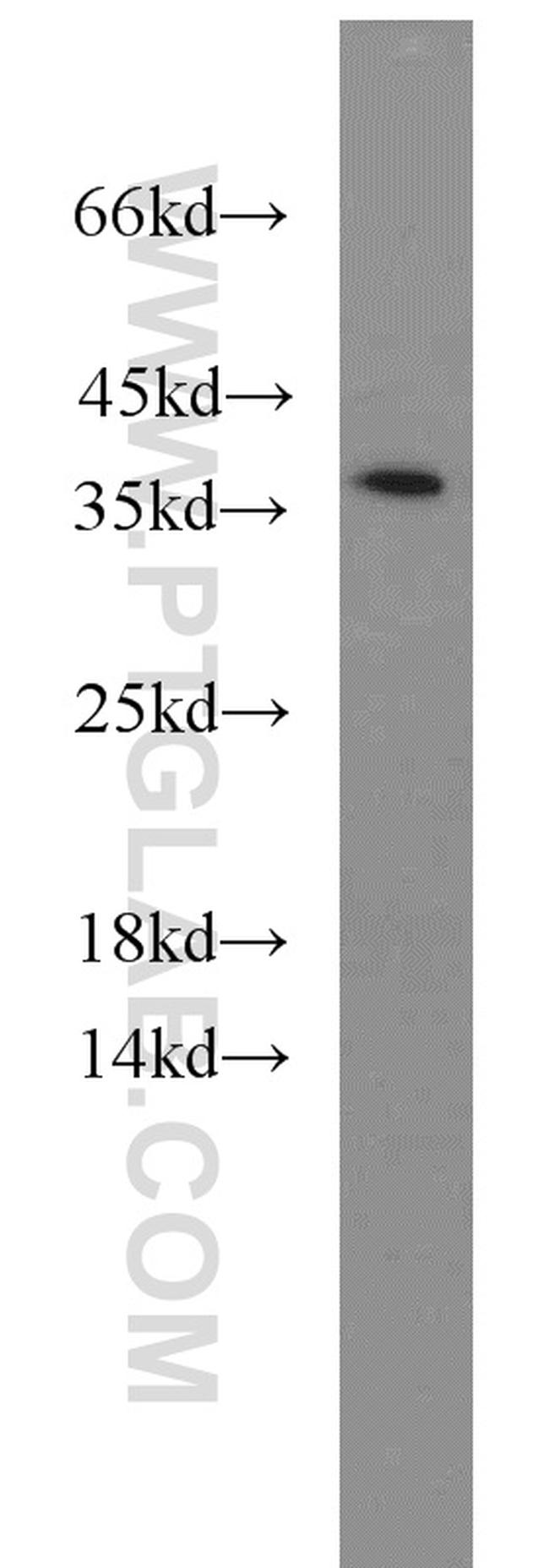 HTRA2 Antibody in Western Blot (WB)