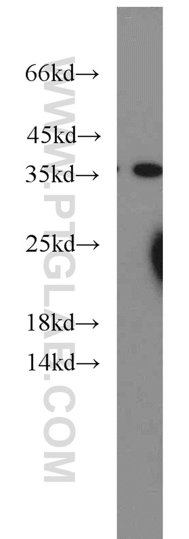 HTRA2 Antibody in Western Blot (WB)