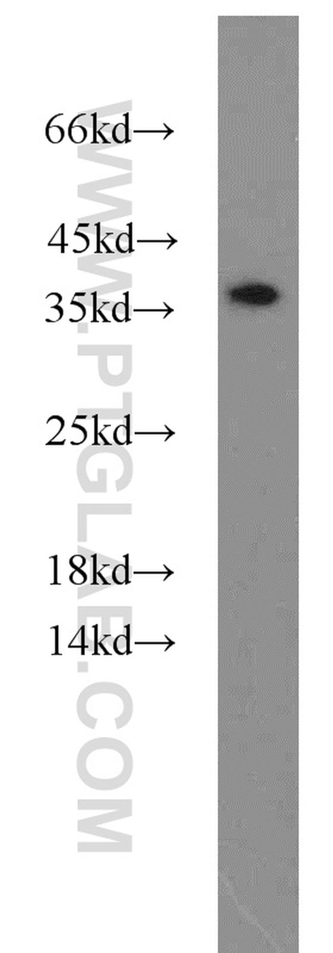 HTRA2 Antibody in Western Blot (WB)