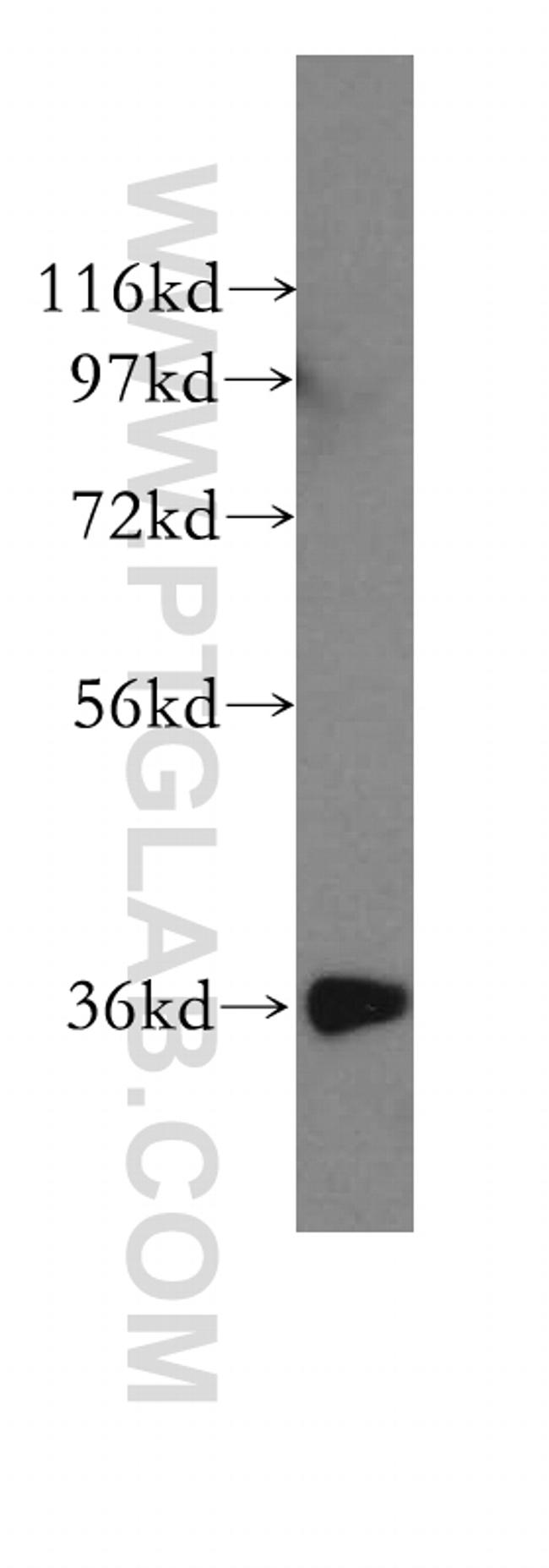 HTRA2 Antibody in Western Blot (WB)