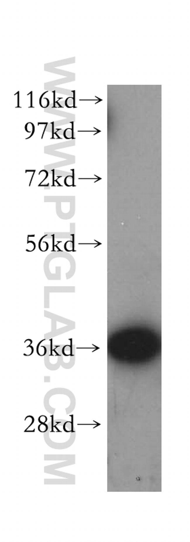 HTRA2 Antibody in Western Blot (WB)