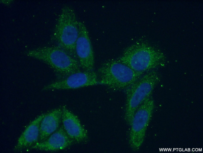 VARS2 Antibody in Immunocytochemistry (ICC/IF)