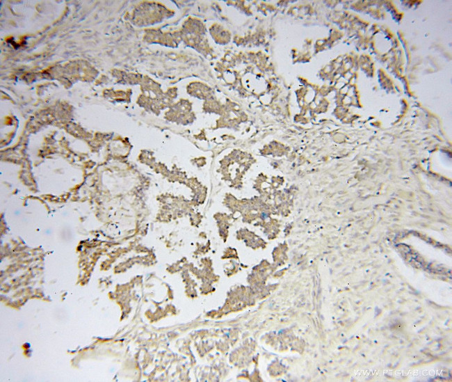 VARS2 Antibody in Immunohistochemistry (Paraffin) (IHC (P))