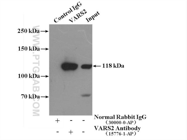VARS2 Antibody in Immunoprecipitation (IP)
