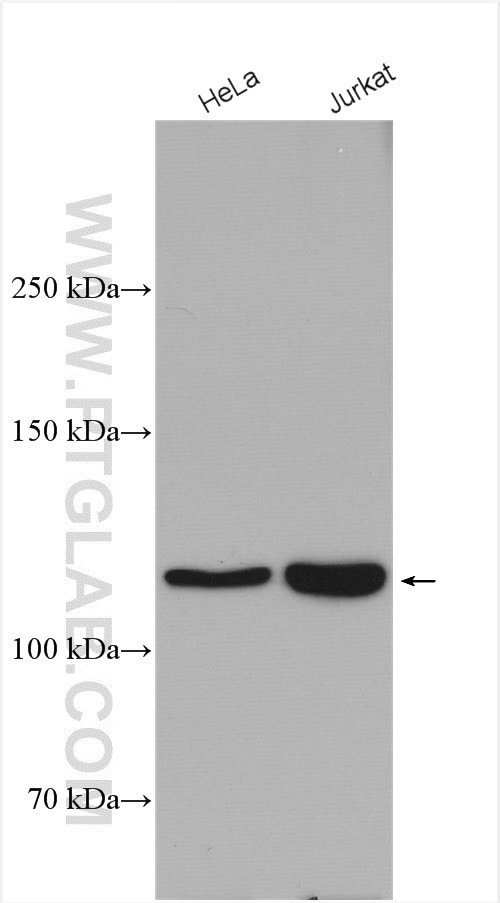 VARS2 Antibody in Western Blot (WB)