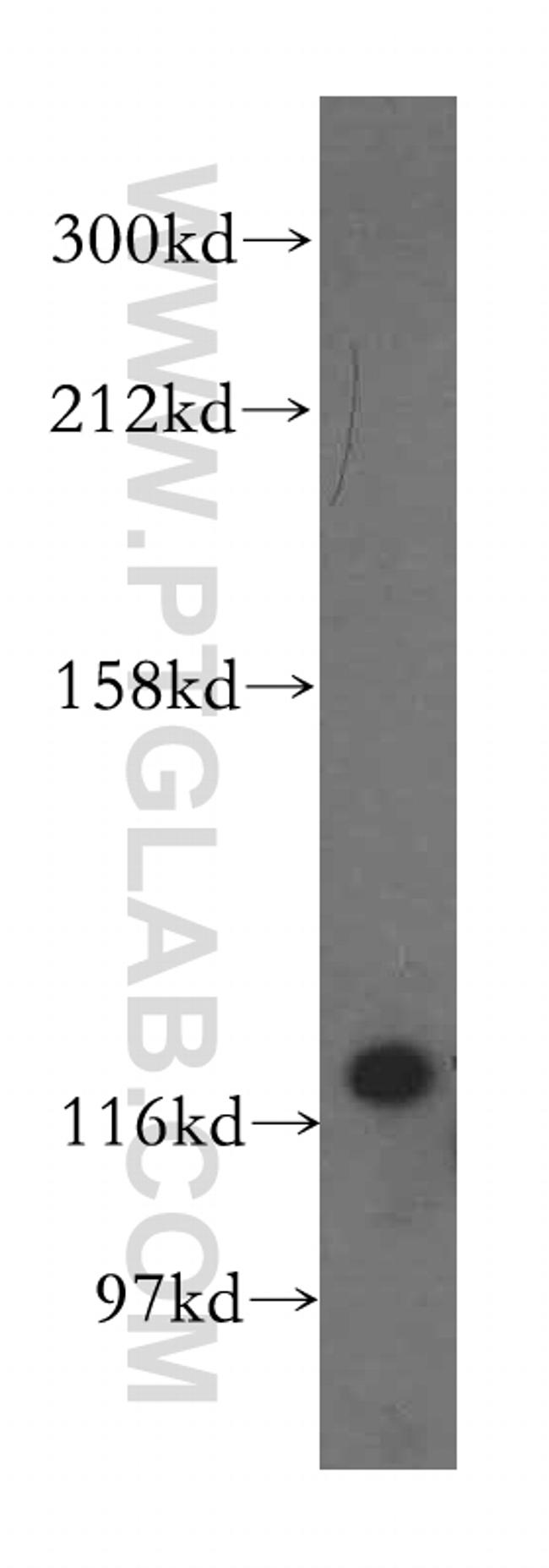 VARS2 Antibody in Western Blot (WB)