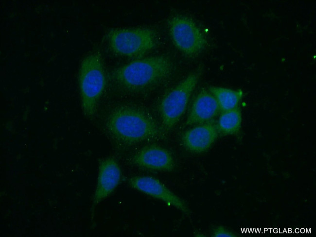 HLA class I (HLA-C) Antibody in Immunocytochemistry (ICC/IF)