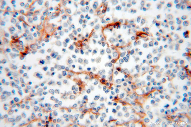 HLA class I (HLA-C) Antibody in Immunohistochemistry (Paraffin) (IHC (P))