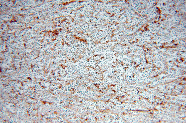 HLA class I (HLA-C) Antibody in Immunohistochemistry (Paraffin) (IHC (P))