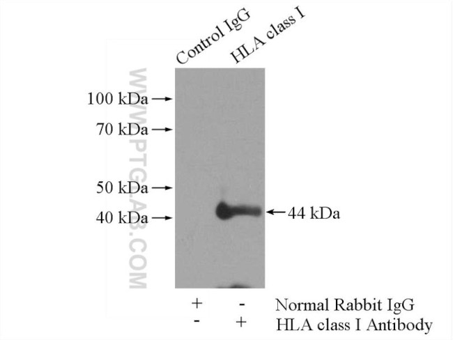 HLA class I (HLA-C) Antibody in Immunoprecipitation (IP)