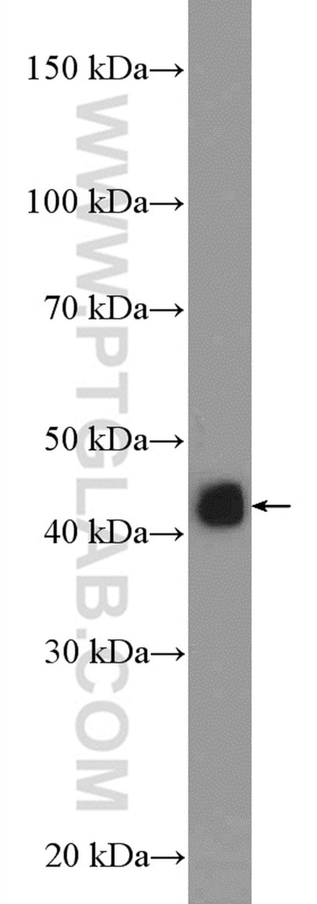 HLA class I (HLA-C) Antibody in Western Blot (WB)