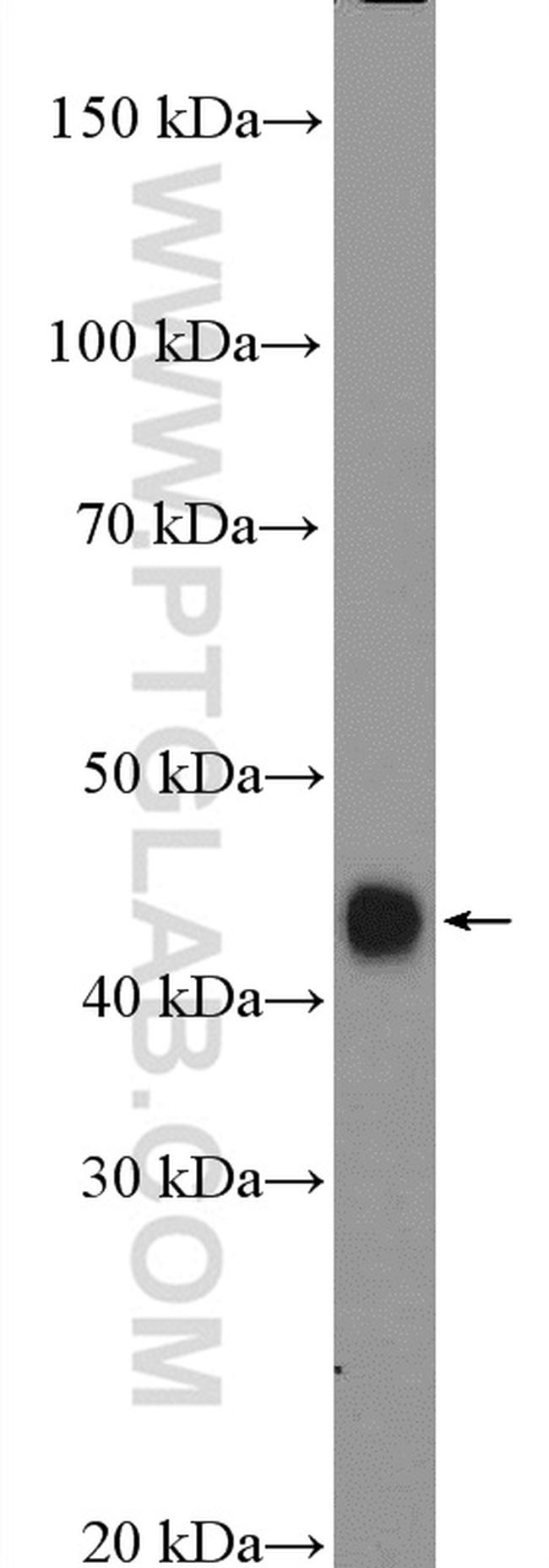 HLA class I (HLA-C) Antibody in Western Blot (WB)