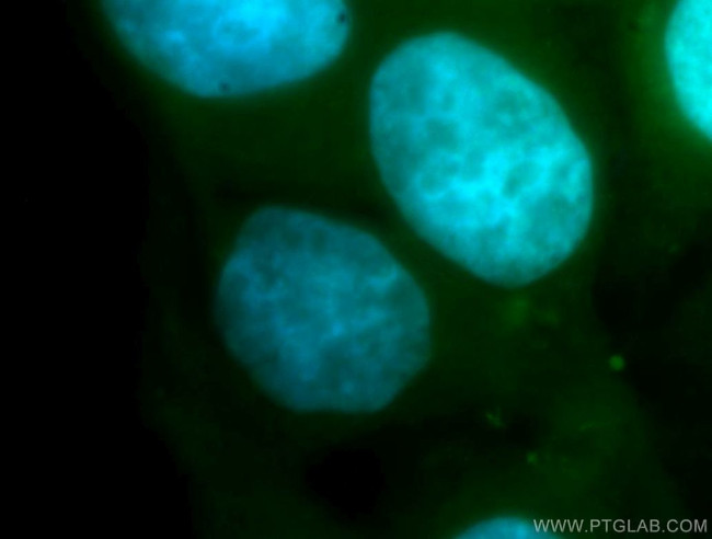 RBM41 Antibody in Immunocytochemistry (ICC/IF)