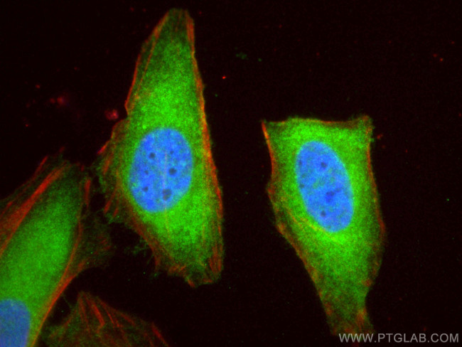 VTA1 Antibody in Immunocytochemistry (ICC/IF)