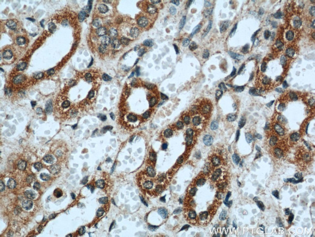 PIN4 Antibody in Immunohistochemistry (Paraffin) (IHC (P))