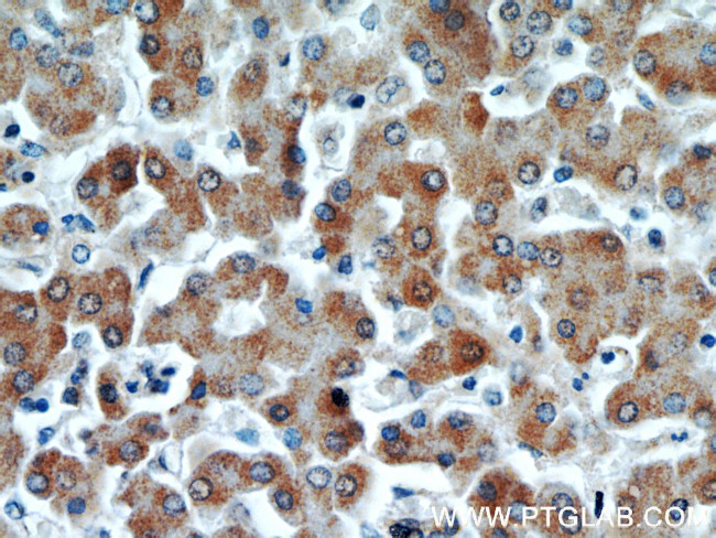 PIN4 Antibody in Immunohistochemistry (Paraffin) (IHC (P))