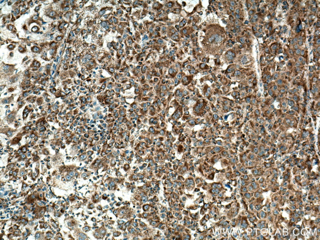 PIN4 Antibody in Immunohistochemistry (Paraffin) (IHC (P))