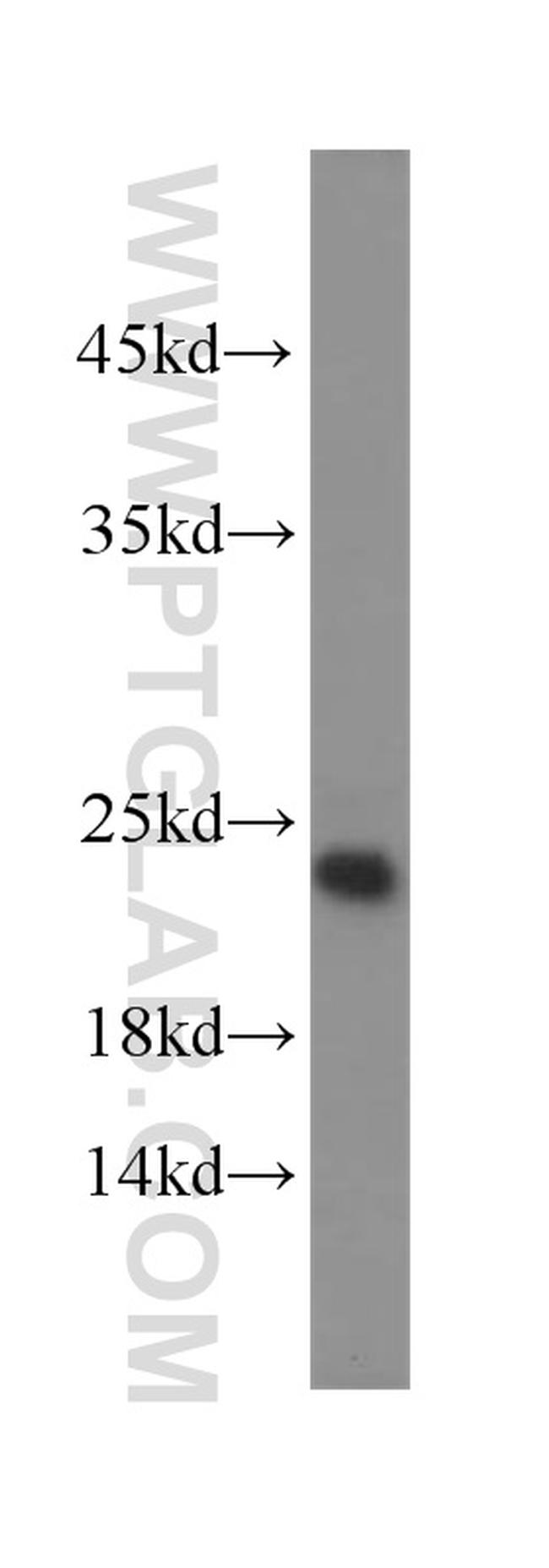 TNFAIP8 Antibody in Western Blot (WB)