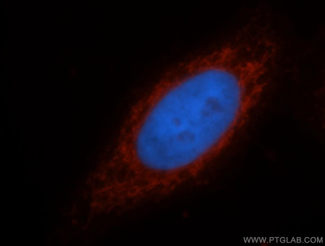 ATF6B Antibody in Immunocytochemistry (ICC/IF)