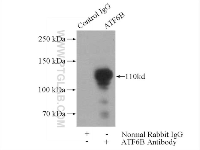 ATF6B Antibody in Immunoprecipitation (IP)