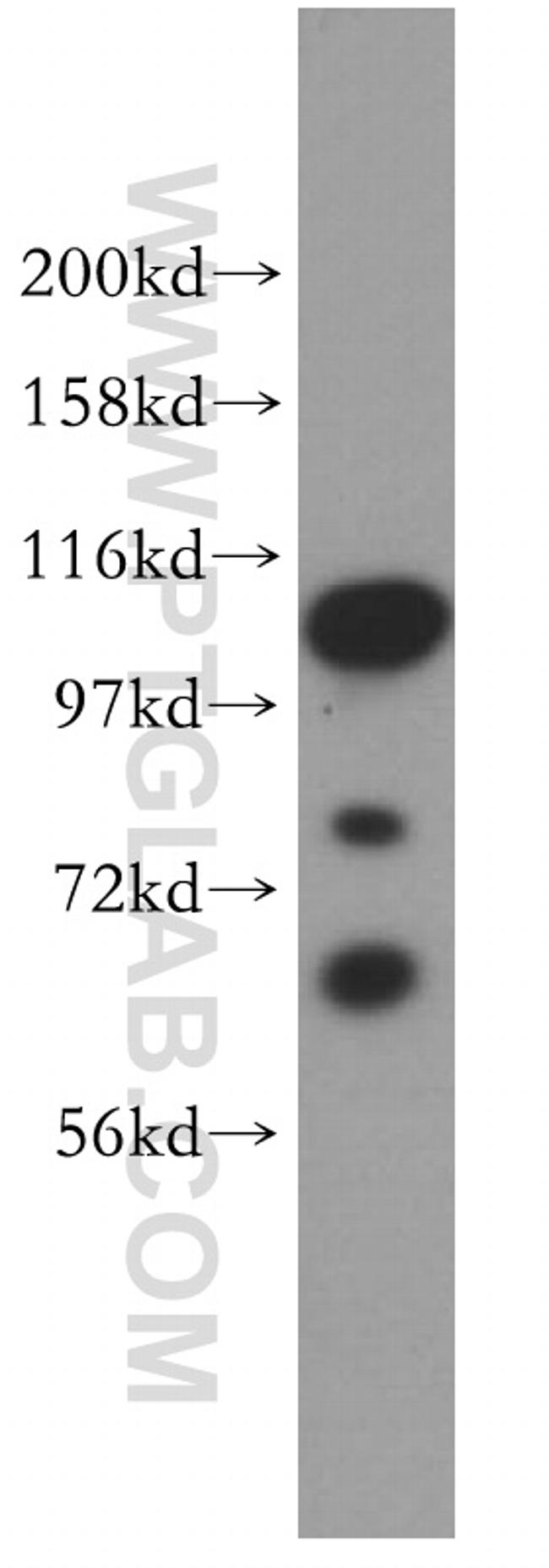 ATF6B Antibody in Western Blot (WB)