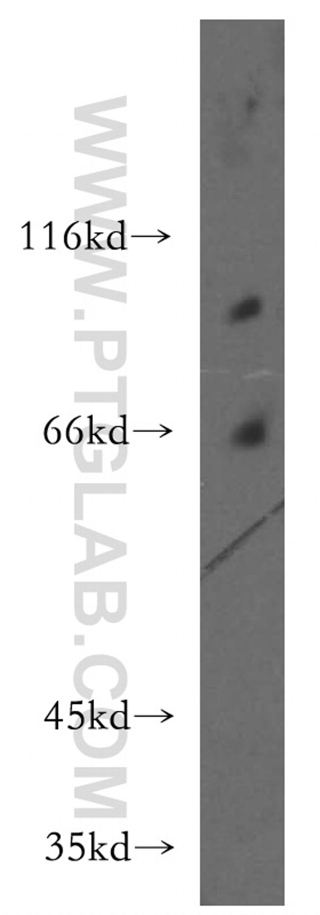 CHPF-N terminal Antibody in Western Blot (WB)