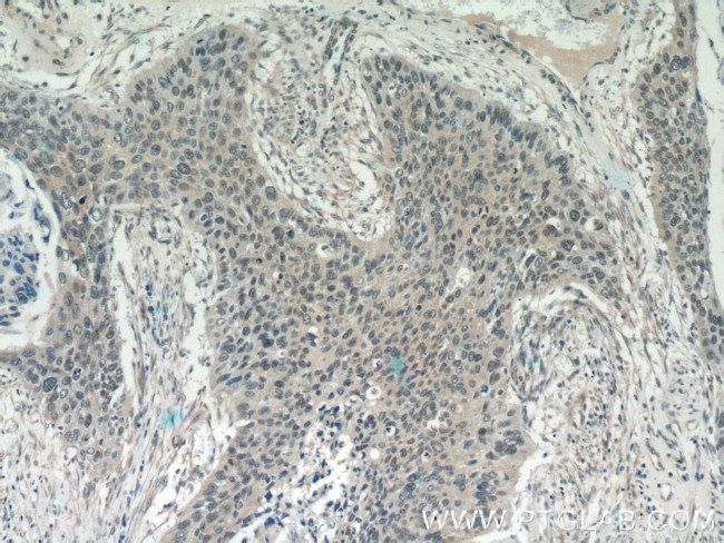 NHP2L1 Antibody in Immunohistochemistry (Paraffin) (IHC (P))