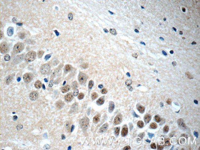 NHP2L1 Antibody in Immunohistochemistry (Paraffin) (IHC (P))