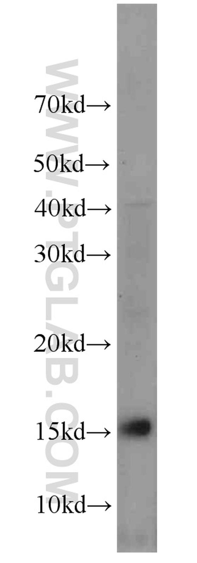 NHP2L1 Antibody in Western Blot (WB)