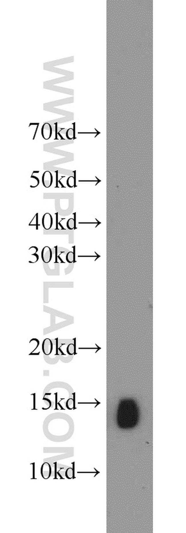 NHP2L1 Antibody in Western Blot (WB)