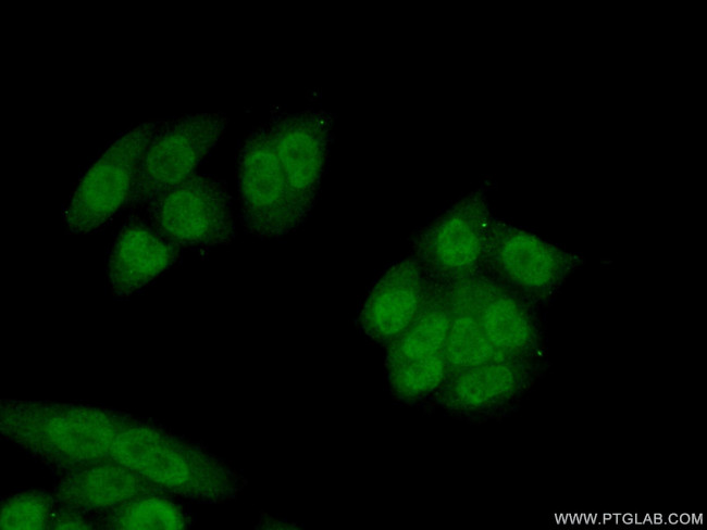 NAT5 Antibody in Immunocytochemistry (ICC/IF)