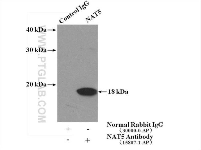 NAT5 Antibody in Immunoprecipitation (IP)