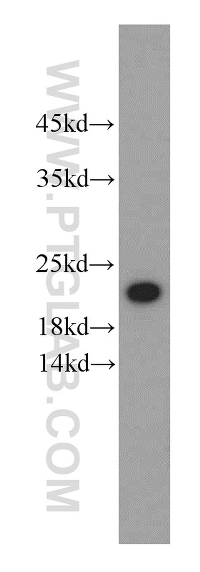 Alpha B Crystallin Antibody in Western Blot (WB)