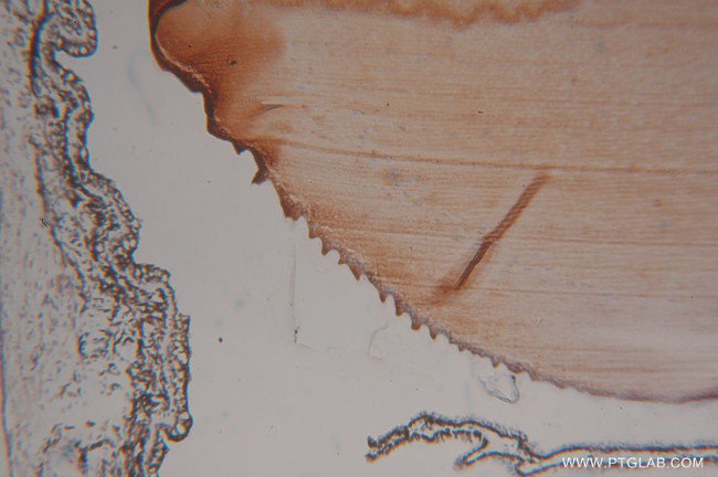 Alpha B Crystallin Antibody in Immunohistochemistry (Paraffin) (IHC (P))