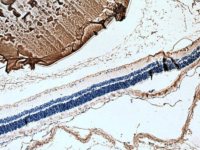 Alpha B Crystallin Antibody in Immunohistochemistry (Paraffin) (IHC (P))