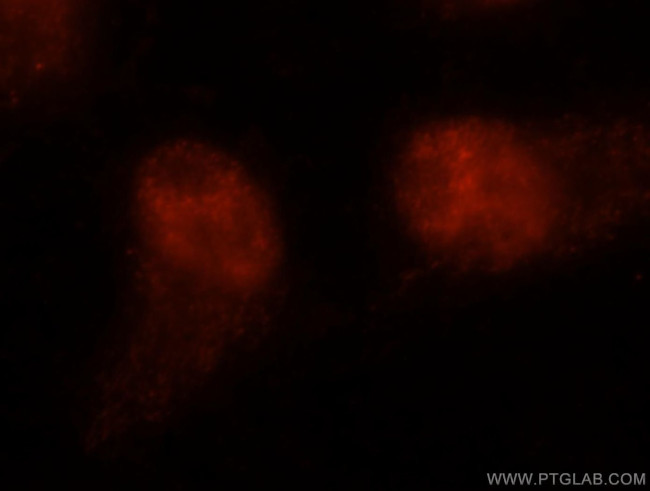 ANP32A Antibody in Immunocytochemistry (ICC/IF)