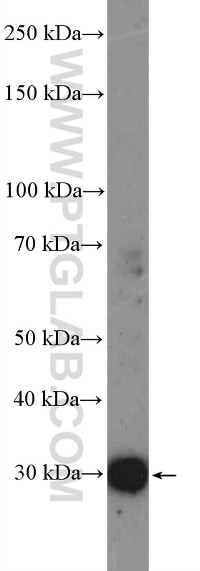 ANP32A Antibody in Western Blot (WB)