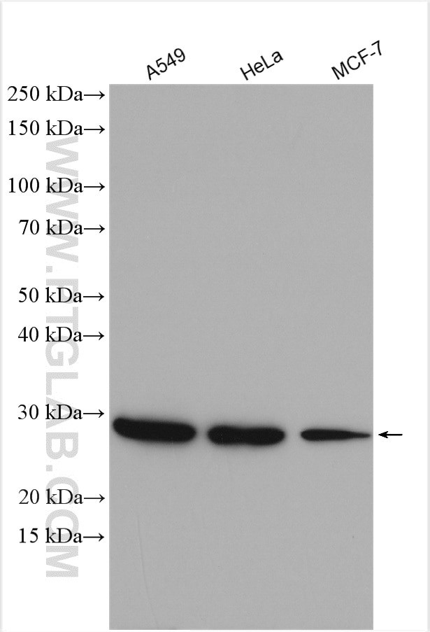 ANP32A Antibody in Western Blot (WB)