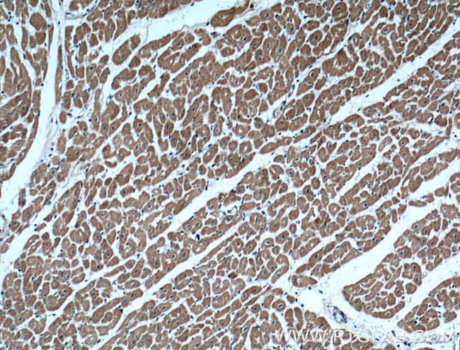 UBE2O Antibody in Immunohistochemistry (Paraffin) (IHC (P))