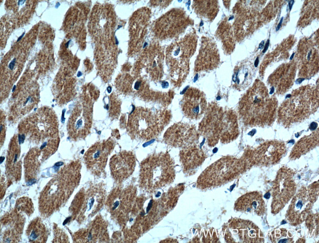 UBE2O Antibody in Immunohistochemistry (Paraffin) (IHC (P))