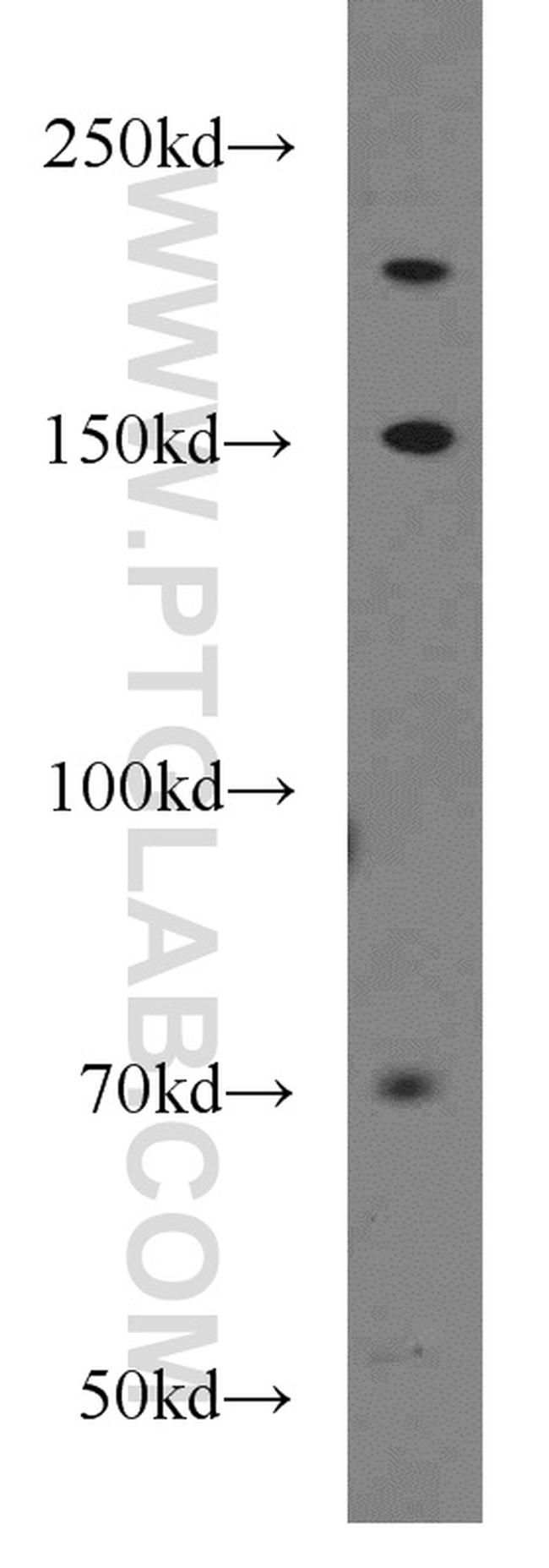 UBE2O Antibody in Western Blot (WB)