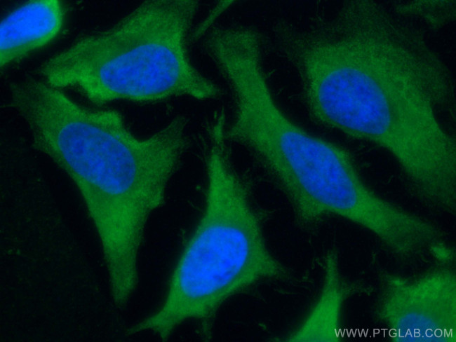 PRDX1 Antibody in Immunocytochemistry (ICC/IF)